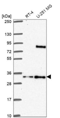 FAM92A1 Antibody, Novus Biologicals 25 &mu;L; FAM92A1 Antibody; Unconjugated:Antibodies,